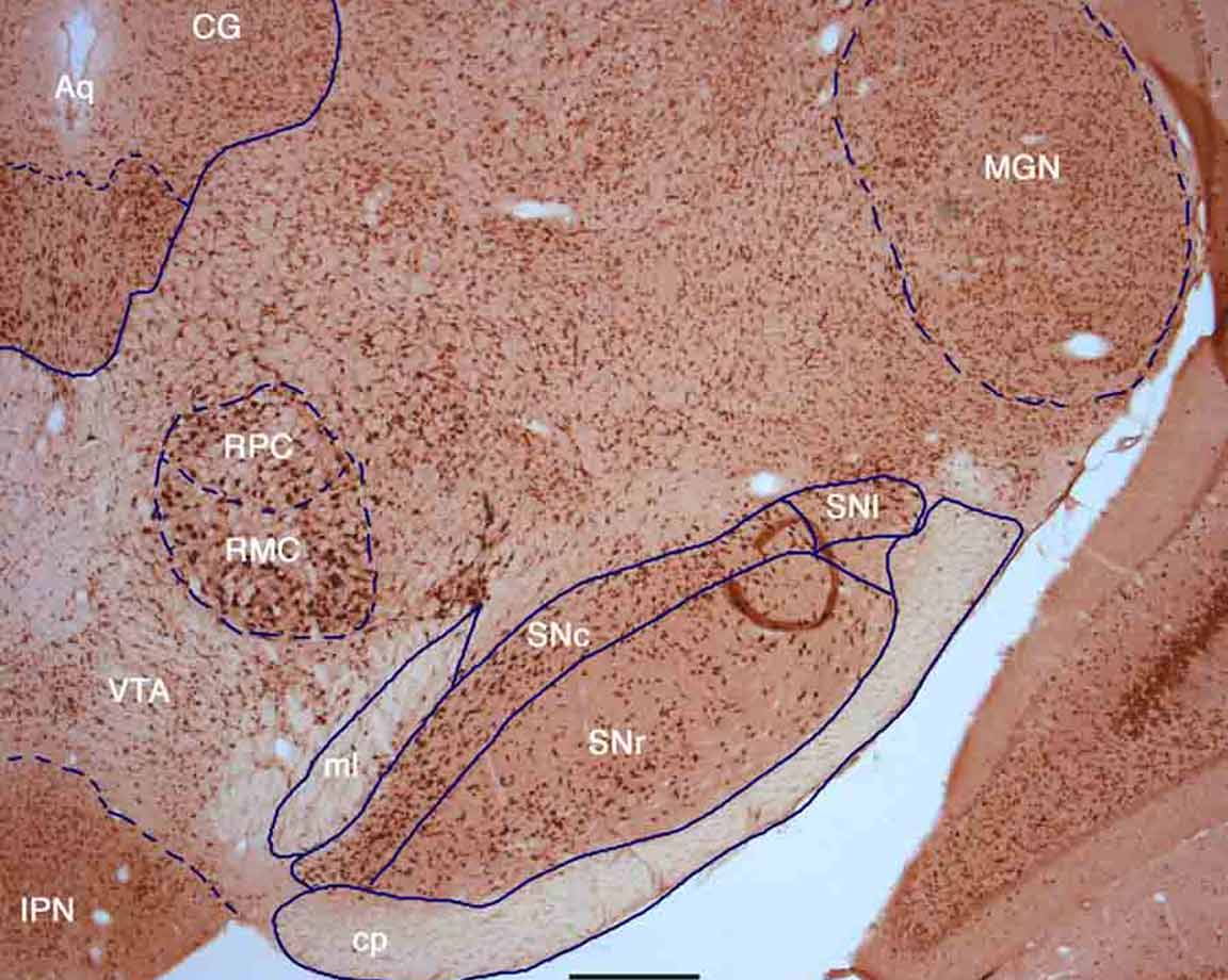 Hu_labeling_in_rat_mid