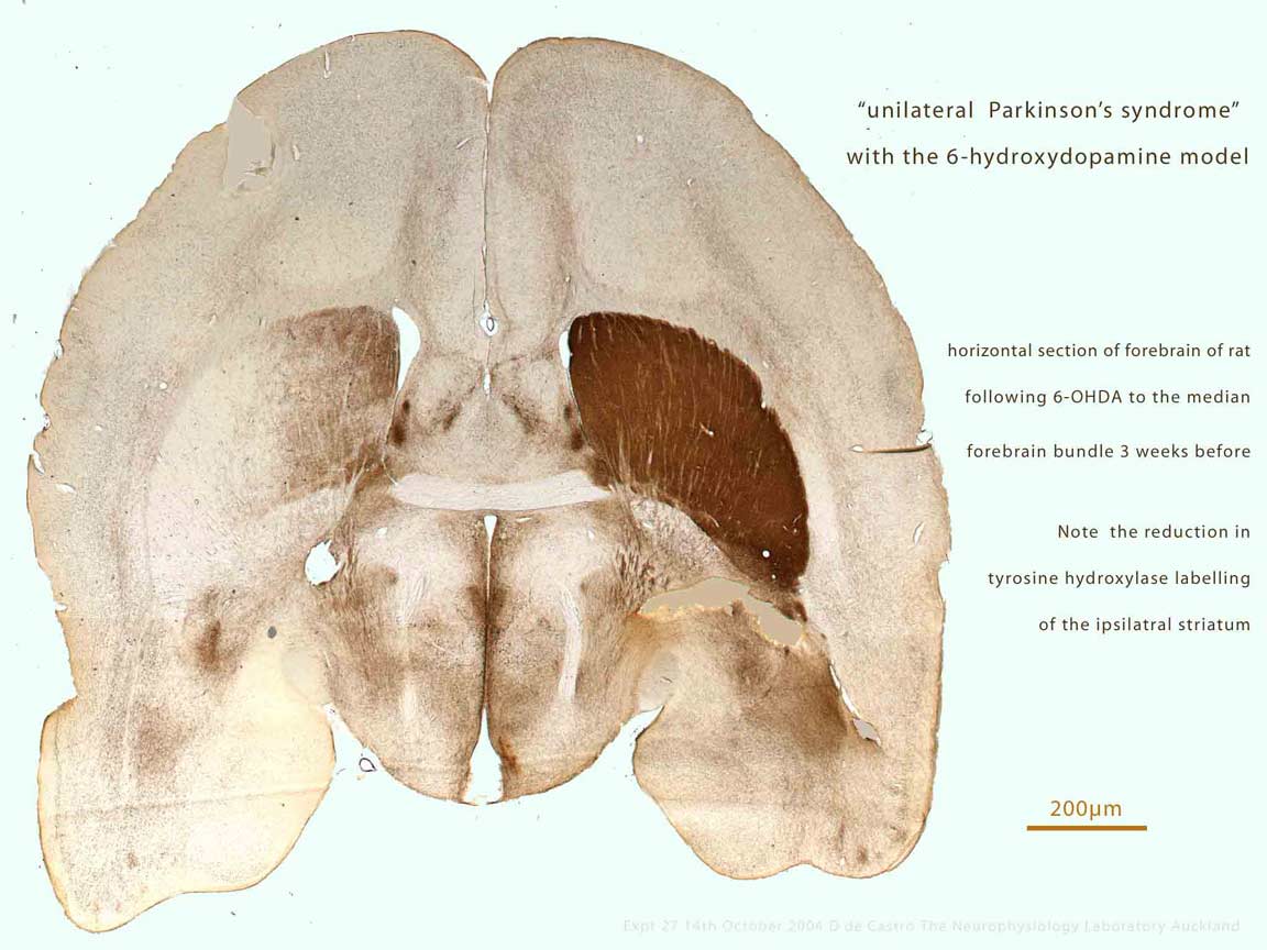 dt-27-6OHDA-forebrain