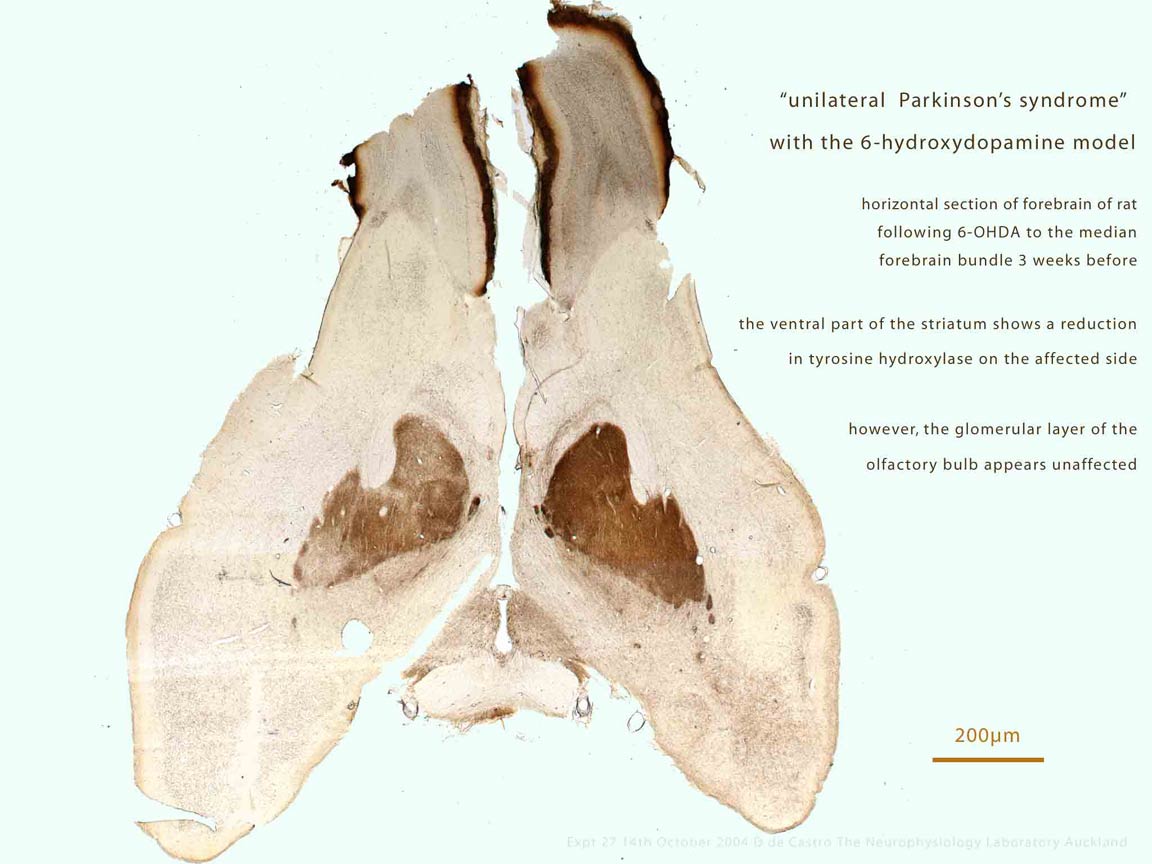 dt-27-6OHDAuniOlfact