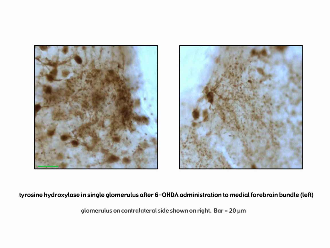 dt-28_glomeruli