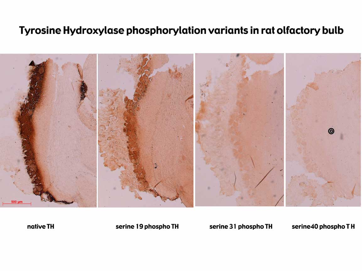 dt_olfactory_bulb