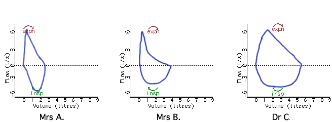 pnuemotachography data