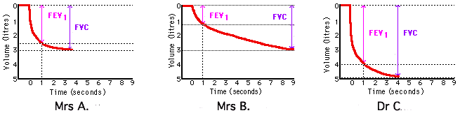 spirometry data